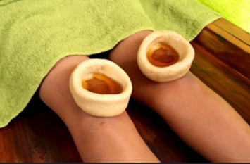 Janu Vasti Ayurvedic treatment for Knee Pain and Arthritis at Shree Aayurbhava Ayurveda hospital in Vijayawada